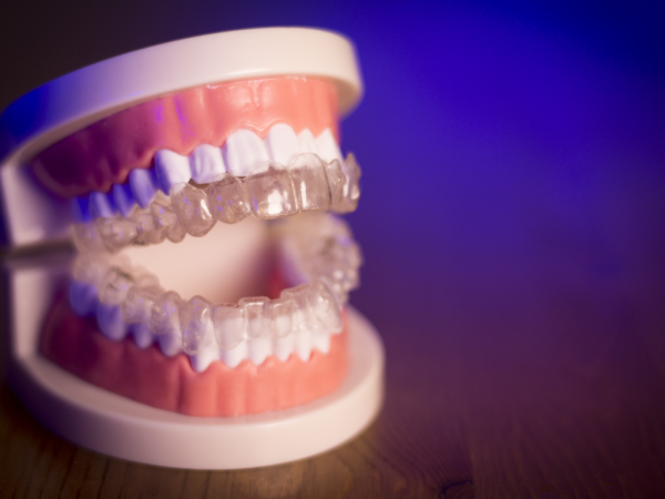 Belmont Dental Surgery Launches 12-Month Invisalign Treatment Plan in Perth