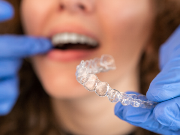 Totalcare Dental and Dermal Introduces Invisalign Orthodontic Care in Bondi Junction