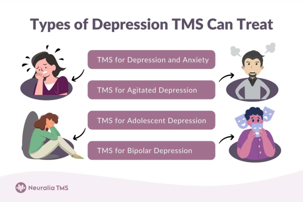 Neuralia TMS Provides Innovative TMS Depression Treatment for Patients in Perth, WA