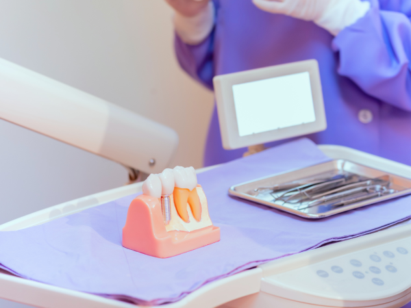 Emergency Dentist Perth Specialises in Same-Day False Teeth Repair Services in Perth