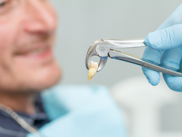 JC Dental Como Offers Safe and Efficient Wisdom Teeth Removal Services in Perth