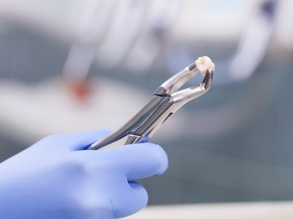 Emergency Dentist Perth Expands Emergency Tooth Extraction Services for Immediate Relief