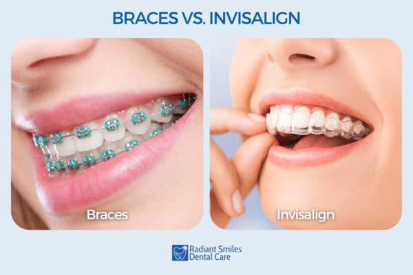 Radiant Smiles Dental Care Expands with Customised Invisalign Packages for Perfect Smiles in Perth