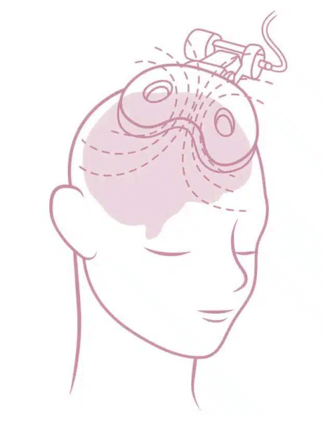 Neuralia TMS Opens TMS Clinic in Kardinya as Demand for Mental Health Solutions Grows