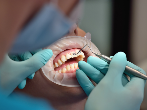 Radiant Smiles Dental Care Enhances Patient Experience with Expert Dentist Services in Perth