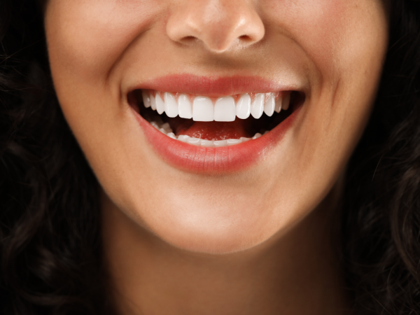 Totalcare Dental and Dermal Enhances Porcelain Veneer Offerings in Bondi Junction for Stunning Smiles